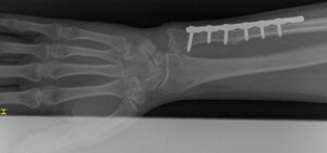 X-ray of the Past and Future